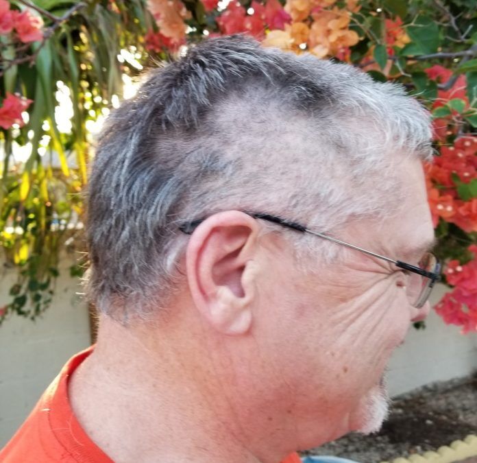 hair