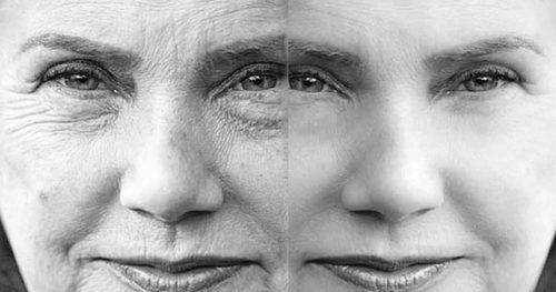 reverse-ageing-treatment-service-500x500
