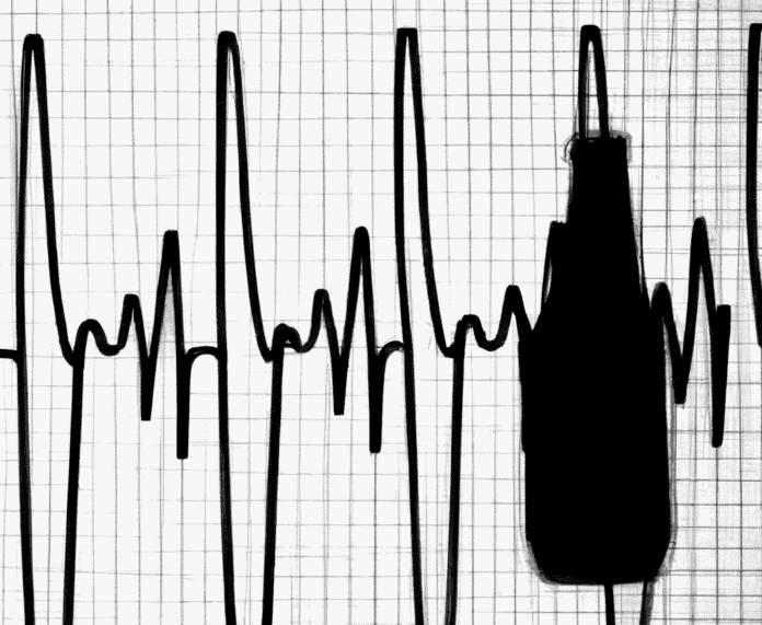 BEERHEART a black and white photo of a heart beat