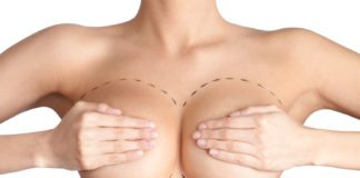 #Health: Exquisite breasts are within reach - A person taking a selfie - Plastic surgery