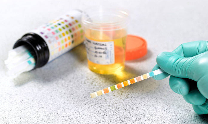 DRUG TEST - A close up of a toy - Clinical urine tests