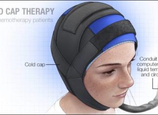 a medical illustration of-cold-cap-therapy for chemotherap patients