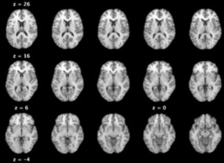 a group of brain images showing different areas of the brain