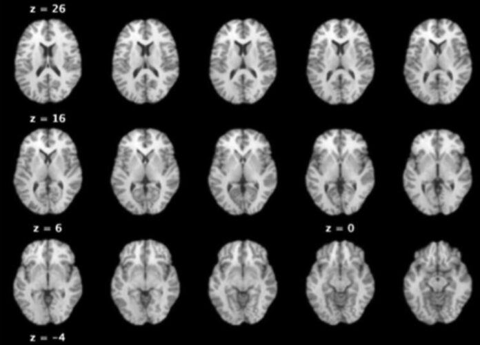 a group of brain images showing different areas of the brain