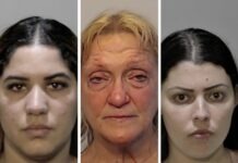 a series of photos of a woman's face before and after plastic surgery